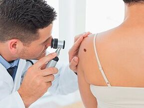 The doctor examines the papilloma about it is recommended to remove it with drugs