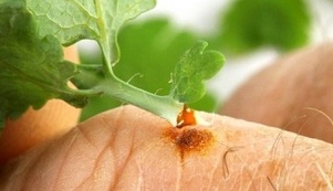 how to remove wart with celandine